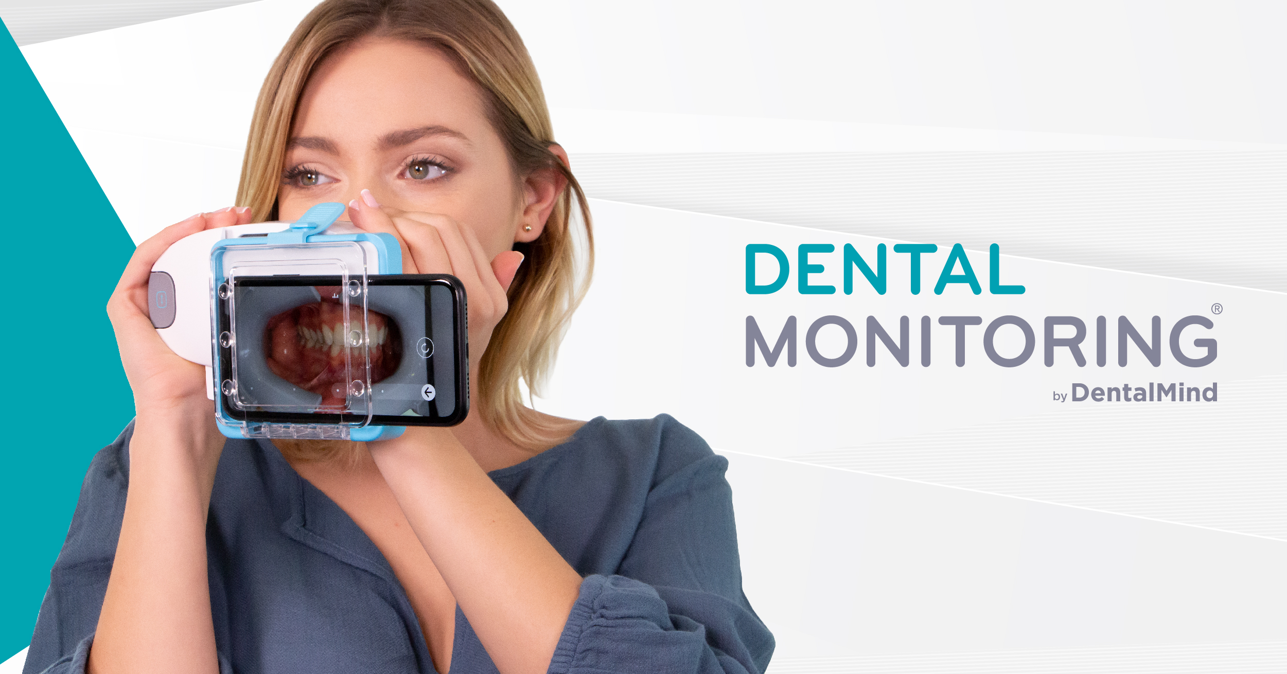 Dental Monitoring Treatment Made Simple Miller Orthodontics Dental Monitoring Treatment Made Simple Miller Orthodontics
